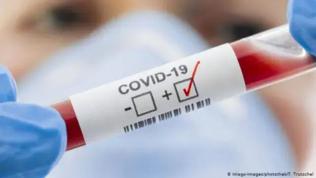 País conta com segundo óbito de covid-19.