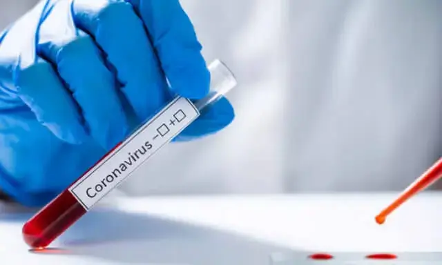 OMS diz que pandemia da Covid-19 está abrandar