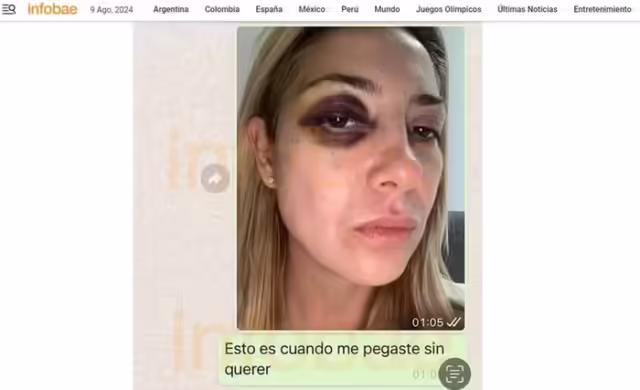 Fabiola Yañez acusa ex-presidente Alberto Fernández de violência doméstica com provas de agressões