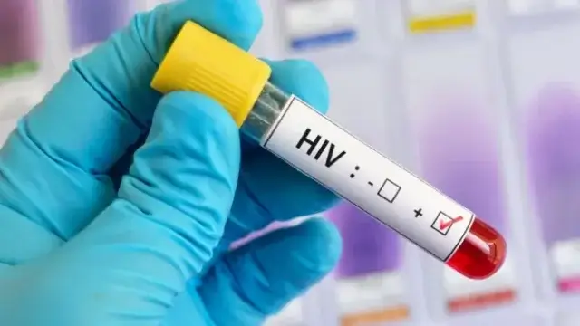ONU- Corte de financiamentos pode gerar aumento de 2 mil infecções diárias por HIV