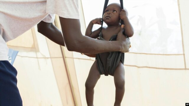 Desnutrição crónica compromete o futuro de 38% das crianças em Moçambique